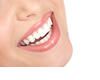 Sorriso
