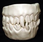 Fuori dai denti