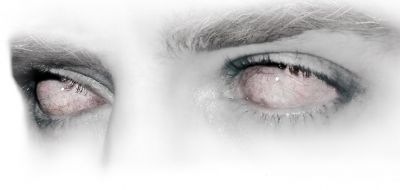 La cecit� che vinse