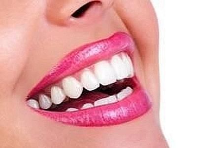 I sorrisi delle donne