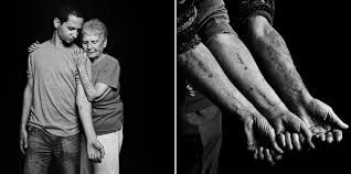 Memoria di tracce sulla pelle