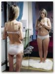 Anoressia