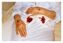 Gioiose Piaghe a Celebrar Amore