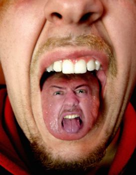 Dottore, dottore ho perso la lingua!