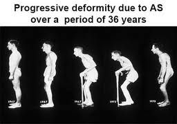 Alla memoria delle dodici scomparse  