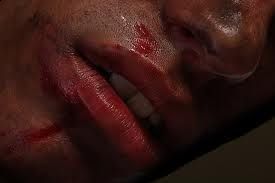 Gocce di sangue sulle labbra