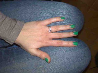 L'ingordigia nel peloponneso antico