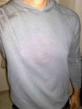 Pulviscolo ortogonale della periferia cerebrale